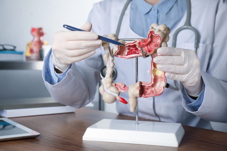 6 Natural Colon Cleanse Methods